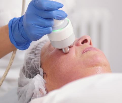 Радиочастотный лифтинг  TriPolar RF regen